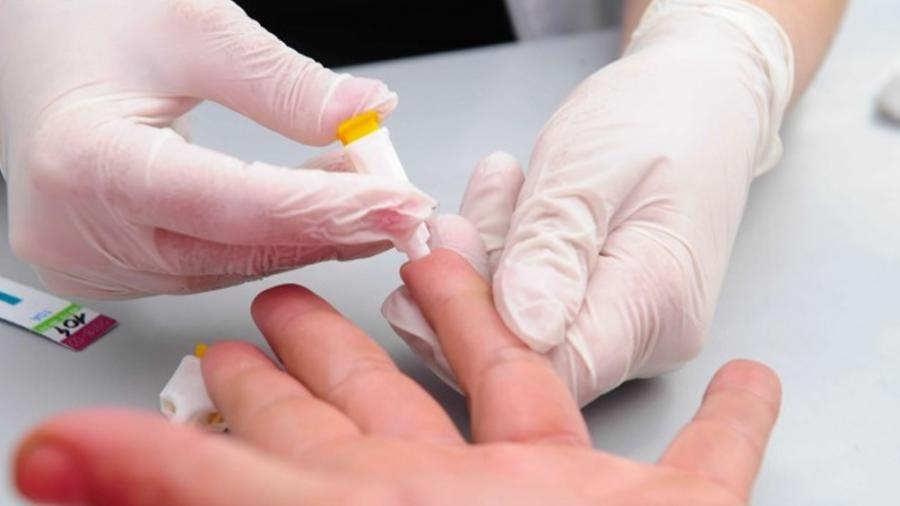 hepatits viral